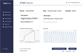 Screenshot of the user interface dashboard of N-Tidal Diagnose showing an example test result
